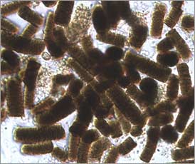 Insect droppings full of partially digested mold spores